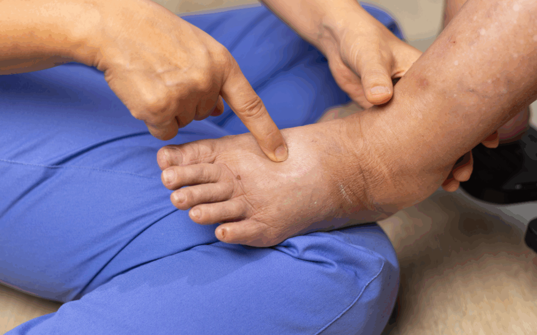 Elderly Skin Care Problems